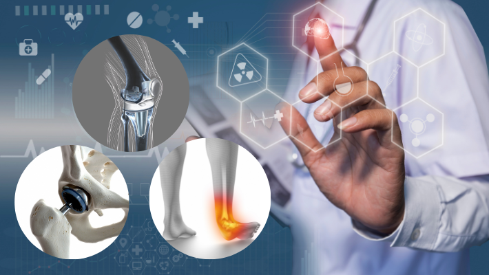 Different Types of Joint Replacement Surgeries