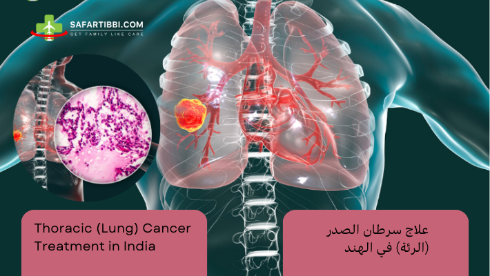Thoracic (Lung) Cancer Treatment in India
