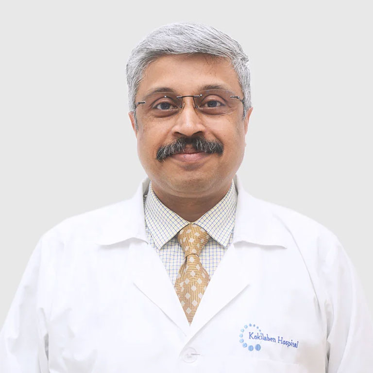 Dr Raghuram Sekhar, Endovascular surgeon in Mumbai - Safartibbi