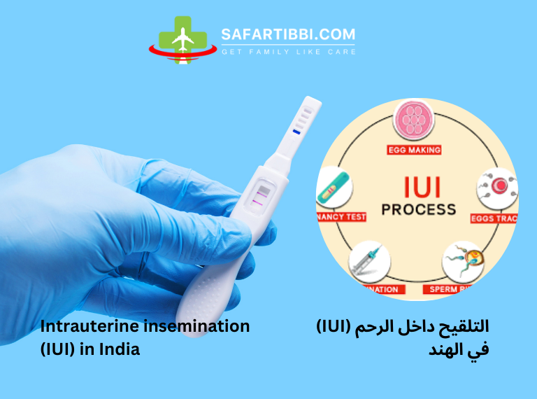 IUI Procedure in India