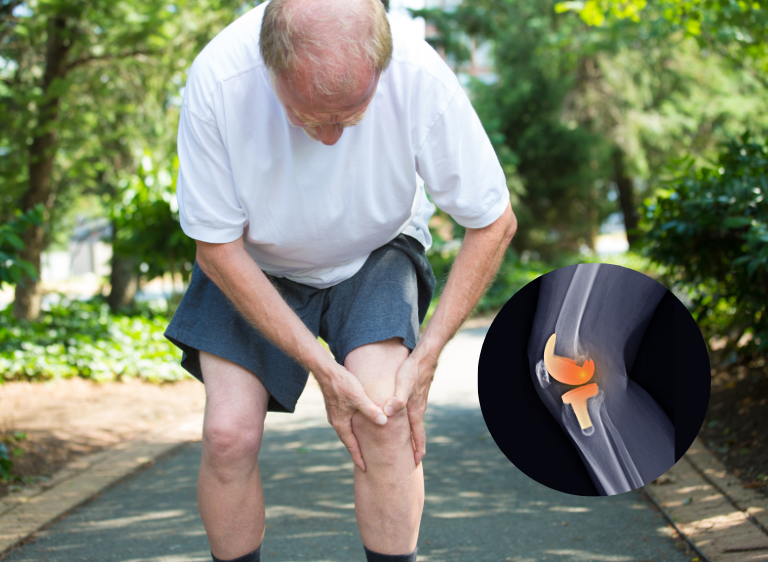 Benefits of Knee Replacement Surgery in India