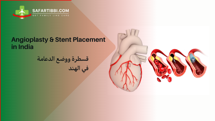 Angioplasty and Stent Placement: A Comprehensive Guide