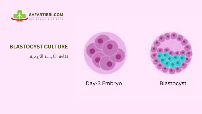 Blastocyst Culture: Procedure, Recommendations, and Advantages