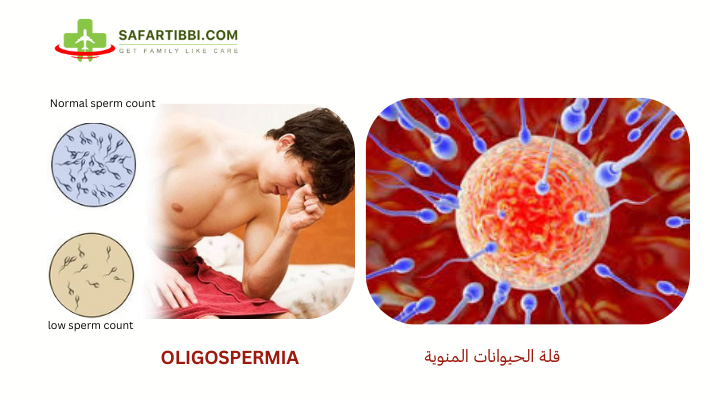Oligospermia: Causes and Treatment Options - Best IVF Specialist