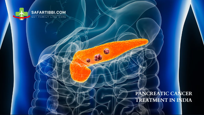 Pancreatic Cancer Treatment in India: Costs and Options