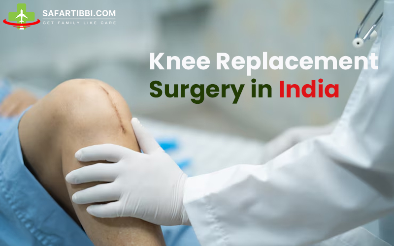 Knee Replacement Surgery in India: A Guide for Patients