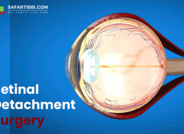 Retinal Detachment Surgery: Diagnosis, Causes & Treatment