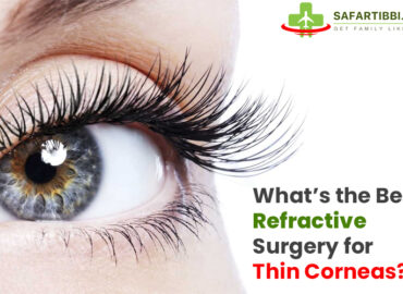 What’s the Best Refractive Surgery for Thin Corneas? A Modern Guide
